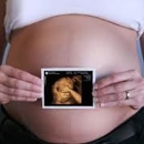 Stork Vision Jenkintown 3D 4D Ultrasounds - Pregnancy Information & Services