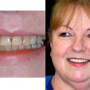 LeDuke, Randall DDS - Implant Dentistry