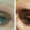 Carefree Beauty Permanent Makeup gallery