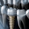 Touchstone Dental & Implants gallery