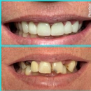 Fontana Dental Group - Cosmetic Dentistry