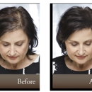 Hair  Replacment Associates - Hair Replacement