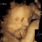 Love View 3D/4D Ultrasound Studio