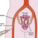 USA Fibroid Centers - Medical Clinics