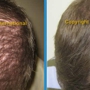 Hair Growth Clinic of CT