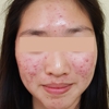 Proderma Acne Clinic gallery