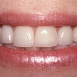 Murray Bruckel DDS - Norwalk, CT