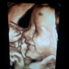 Bubbie's Bebes 4-D Ultrasound Studio gallery