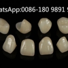 Doi Dental Labs gallery