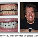 Rock Star Teeth Whitening - Teeth Whitening Products & Services