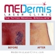 MEDermis Laser Clinic