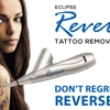 Skinovation | Tattoo Removal gallery