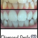 Diamond Smile Whitening - Teeth Whitening Products & Services