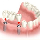 Prosthodontic Associates - Implant Dentistry