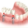 Prosthodontic Associates