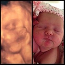 Lexington Fetal Photography - Pregnancy Information & Services
