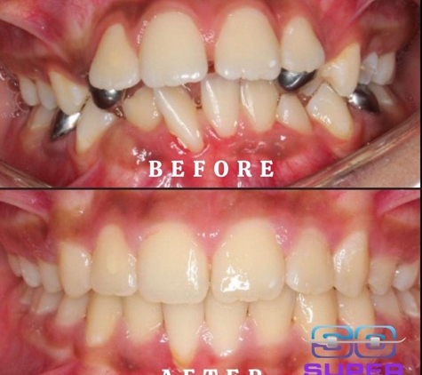 Super Orthodontics - Encino, CA