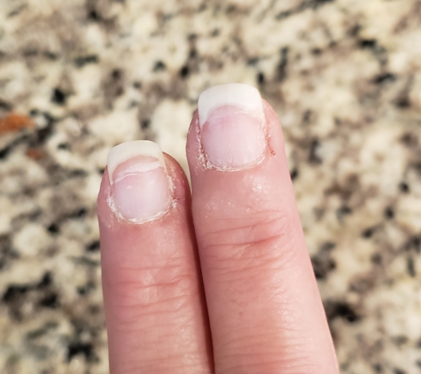 Cindy's Nails - Lexington, KY. Deformed and damaged by Cindy's nails/Nails pro