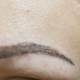 A Nurses Touch Brow Microblading and Electrolysis