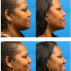 Georgia Center for ENT & Facial Plastic Surgery