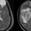 Wake Radiology - MRI (Magnetic Resonance Imaging)