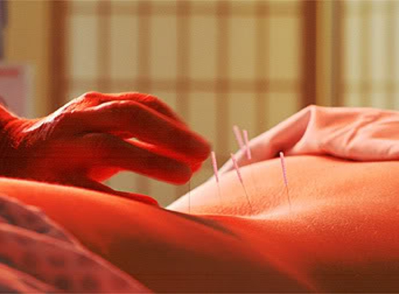 Citywide Chiropractic and Acupuncture - Omaha, NE