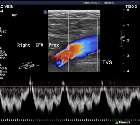 Truffles Vein Specialists - Carrollton, GA