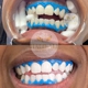 Halo Ali Teeth Whitening