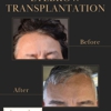 Arocha Hair Restoration gallery