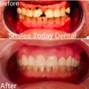 Smiles Today Dental gallery