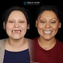 Smile Now Milwaukee Dentures and Implants - Dentists