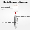 Victoria Village Dentistry - Cosmetic Dentistry
