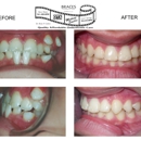 Cohen, Brian P DDS PA - Orthodontists
