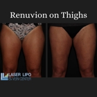 Laser Lipo and Vein Center