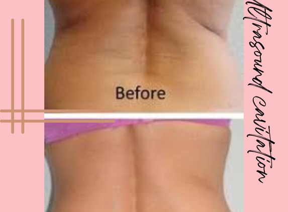 Skulpted Skin the Body Contouring Specialist - Round Rock, TX