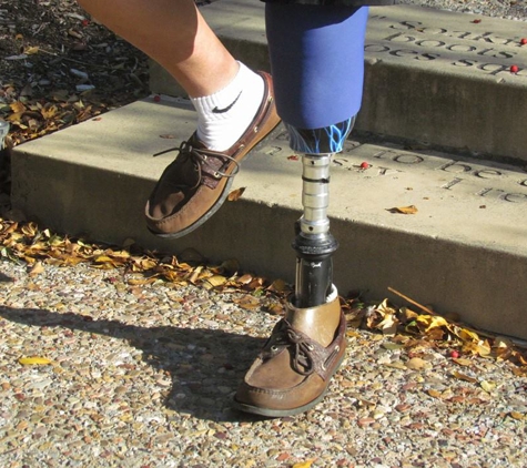 Advanced Prosthetic Research - Plano, TX