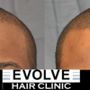 Evolve Hair Clinic gallery