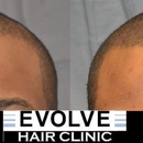 Evolve Hair Clinic - Hair Replacement