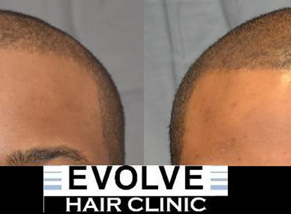 Evolve Hair Clinic