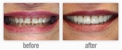 William J. Stewart Jr. DDS and Dr Levi Jurich DMD, Advanced Family & Cosmetic Dentistry - Dental Clinics