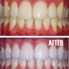 Aria Dental of Annapolis gallery