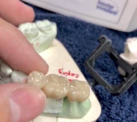 Precision Dental Ceramics Laboratory - Houston, TX