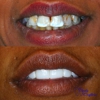 DentaCrafters P gallery
