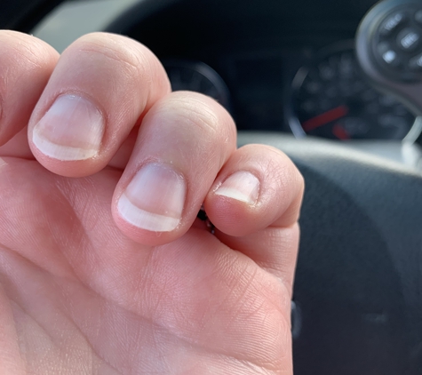 T & C Nails - Haltom City, TX. Uneven. Not completely filed or done correctly.