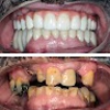 Four Ever Smile Dental Implant Center gallery