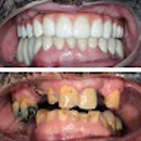 Four Ever Smile Dental Implant Center - Implant Dentistry