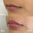 Enve California Aesthetics - Beauty Salons