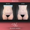 Azure Med Spa gallery