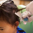 Lice Clinics of America-Treasure Coast