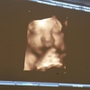 First Glance 3D/4D Ultrasound Studio gallery